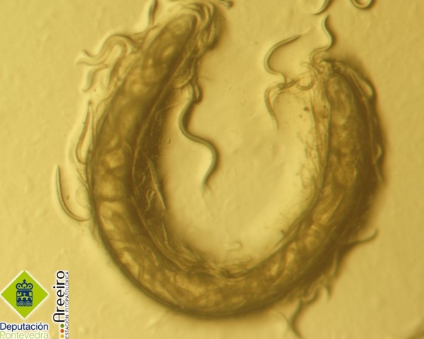 Nematodos Entomopatogenos - Entomopathogenic nematodes - Nematodos entomopatoxenos >> Hembra y juveniles.jpg